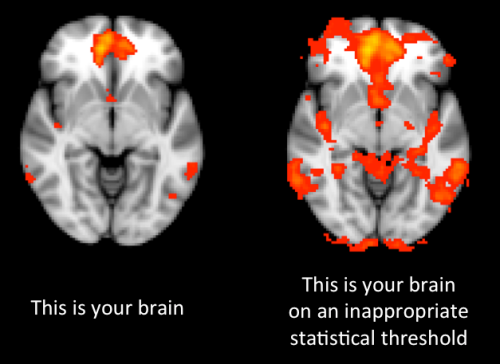 brain_threshold